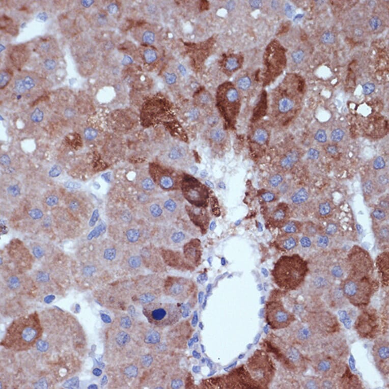 Immunohistochemistry - Anti-Cyclin B2/CCNB2 Antibody [ARC1435] (A306931) - Antibodies.com
