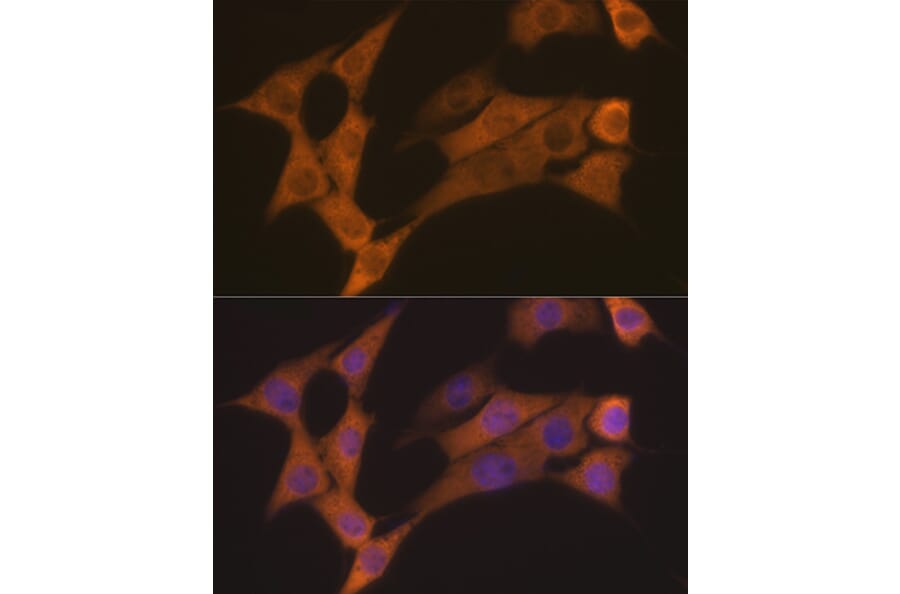 Immunofluorescence - Anti-Cyclin B2/CCNB2 Antibody [ARC1435] (A306931) - Antibodies.com