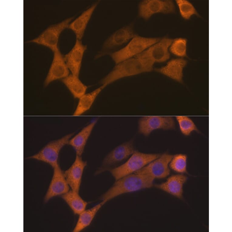 Immunofluorescence - Anti-Cyclin B2/CCNB2 Antibody [ARC1435] (A306931) - Antibodies.com