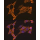 Immunofluorescence - Anti-Cyclin B2/CCNB2 Antibody [ARC1435] (A306931) - Antibodies.com