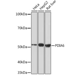 Western Blot - Anti-PDIA6 Antibody [ARC0944] (A306932) - Antibodies.com