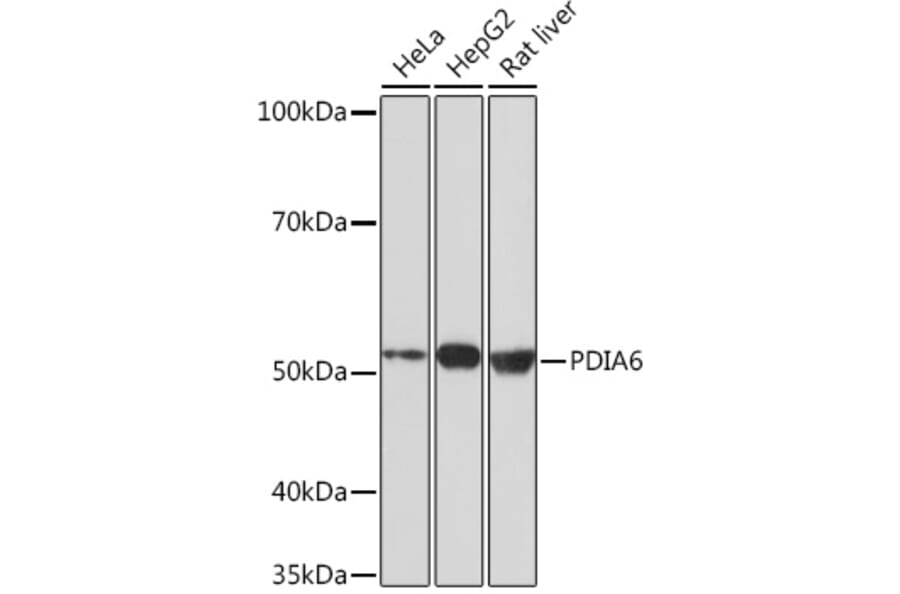 Western Blot - Anti-PDIA6 Antibody [ARC0944] (A306932) - Antibodies.com