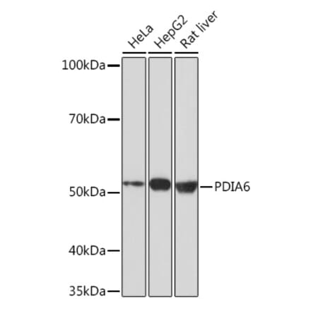 Western Blot - Anti-PDIA6 Antibody [ARC0944] (A306932) - Antibodies.com