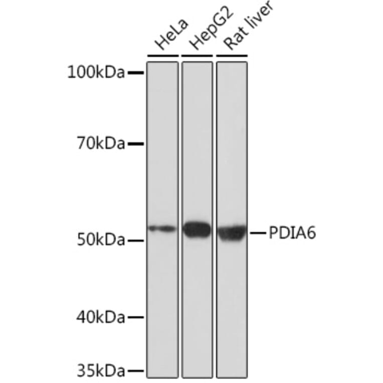Western Blot - Anti-PDIA6 Antibody [ARC0944] (A306932) - Antibodies.com