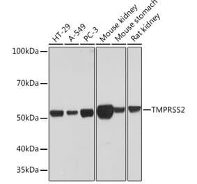 Western Blot - Anti-TMPRSS2 Antibody [ARC1439] (A306933) - Antibodies.com
