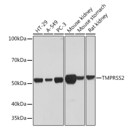 Western Blot - Anti-TMPRSS2 Antibody [ARC1439] (A306933) - Antibodies.com