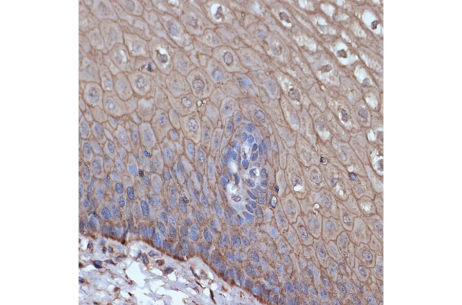 Immunohistochemistry - Anti-TMPRSS2 Antibody [ARC1439] (A306933) - Antibodies.com