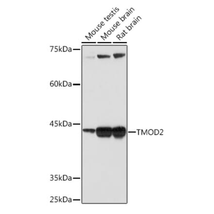 Western Blot - Anti-Tropomodulin 2 Antibody [ARC2318] (A306934) - Antibodies.com