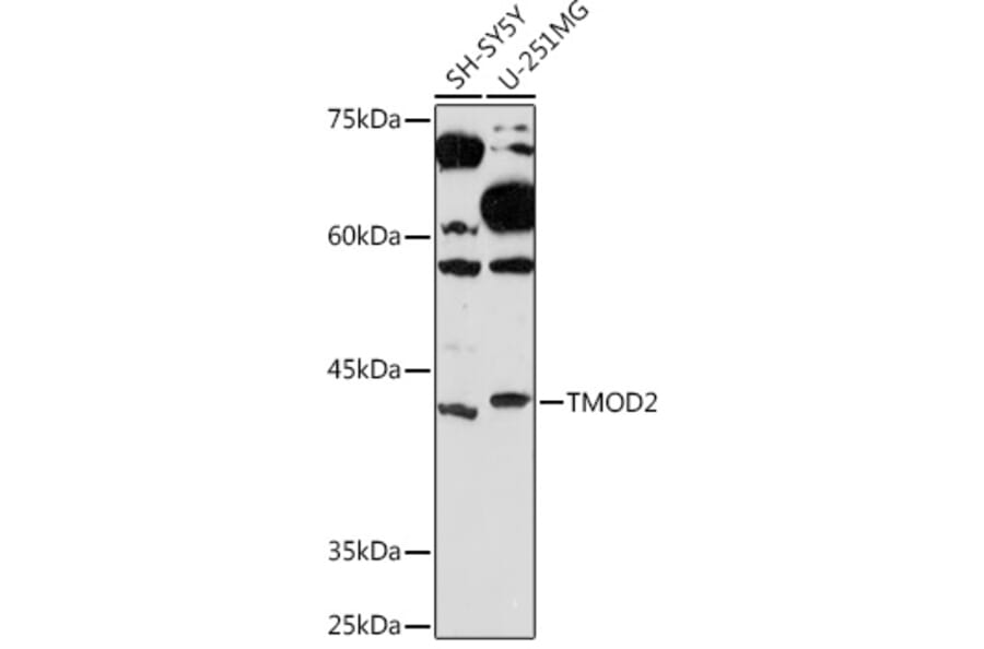 Western Blot - Anti-Tropomodulin 2 Antibody [ARC2318] (A306934) - Antibodies.com