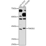 Western Blot - Anti-Tropomodulin 2 Antibody [ARC2318] (A306934) - Antibodies.com