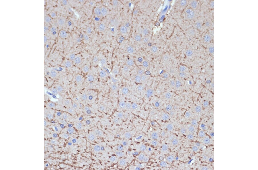 Immunohistochemistry - Anti-Tropomodulin 2 Antibody [ARC2318] (A306934) - Antibodies.com