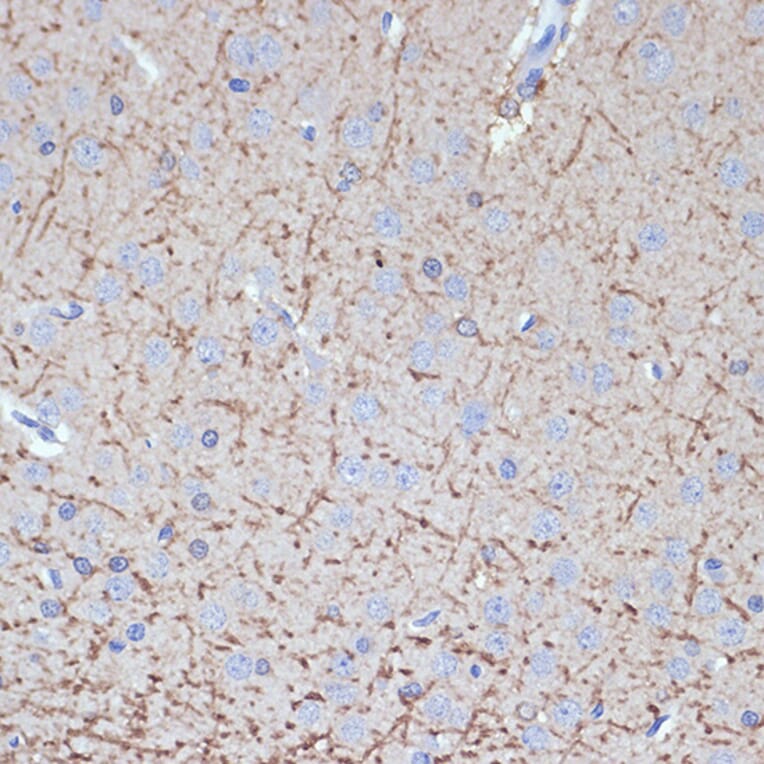 Immunohistochemistry - Anti-Tropomodulin 2 Antibody [ARC2318] (A306934) - Antibodies.com
