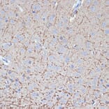 Immunohistochemistry - Anti-Tropomodulin 2 Antibody [ARC2318] (A306934) - Antibodies.com