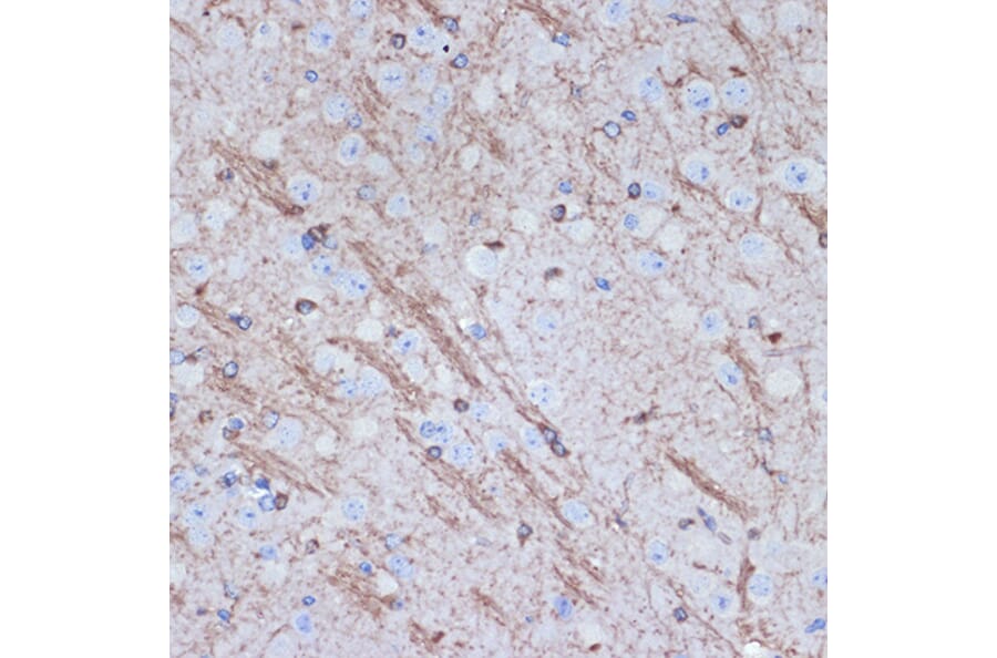 Immunohistochemistry - Anti-Tropomodulin 2 Antibody [ARC2318] (A306934) - Antibodies.com