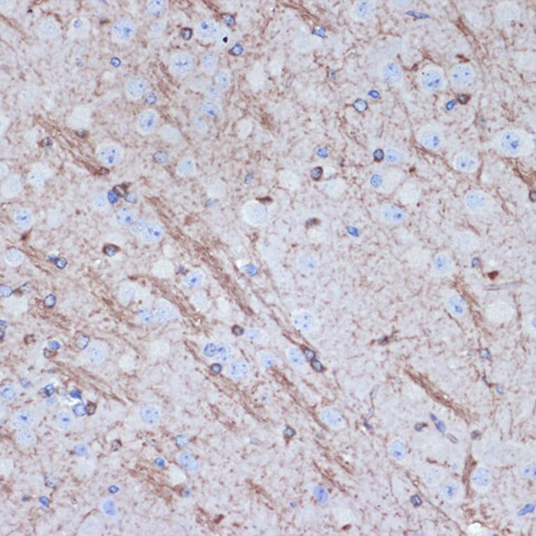 Immunohistochemistry - Anti-Tropomodulin 2 Antibody [ARC2318] (A306934) - Antibodies.com