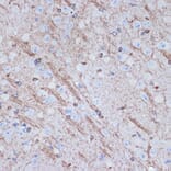 Immunohistochemistry - Anti-Tropomodulin 2 Antibody [ARC2318] (A306934) - Antibodies.com