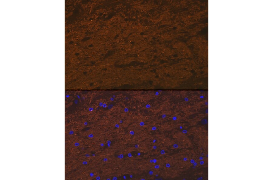 Immunofluorescence - Anti-Tropomodulin 2 Antibody [ARC2318] (A306934) - Antibodies.com