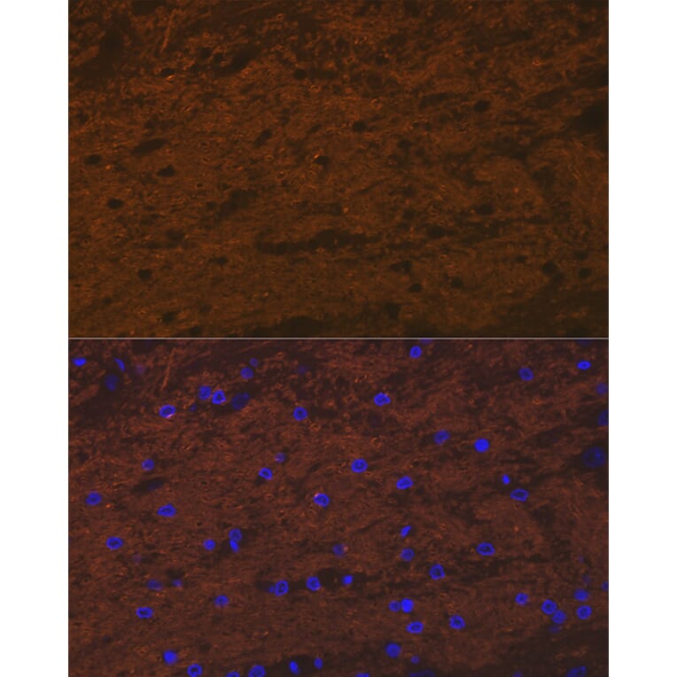 Immunofluorescence - Anti-Tropomodulin 2 Antibody [ARC2318] (A306934) - Antibodies.com