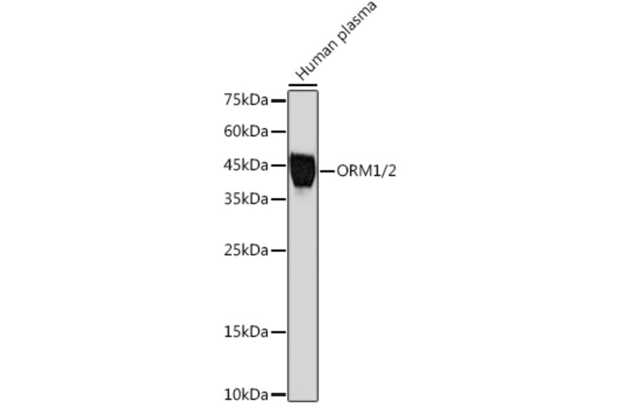 Western Blot - Anti-Alpha 1 Acid Glycoprotein/AGP Antibody [ARC2263] (A306936) - Antibodies.com