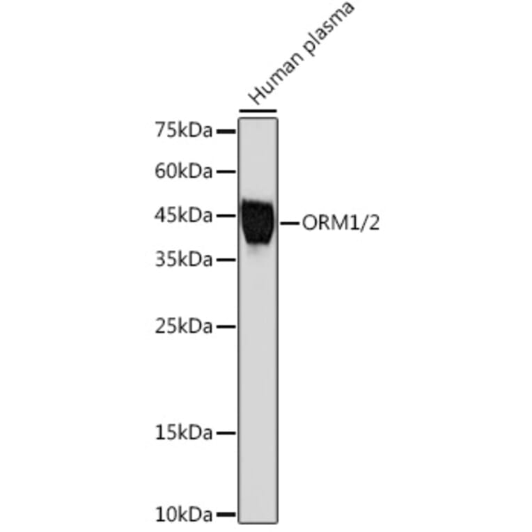 Western Blot - Anti-Alpha 1 Acid Glycoprotein/AGP Antibody [ARC2263] (A306936) - Antibodies.com