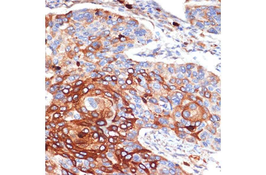 Immunohistochemistry - Anti-Alpha 1 Acid Glycoprotein/AGP Antibody [ARC2263] (A306936) - Antibodies.com