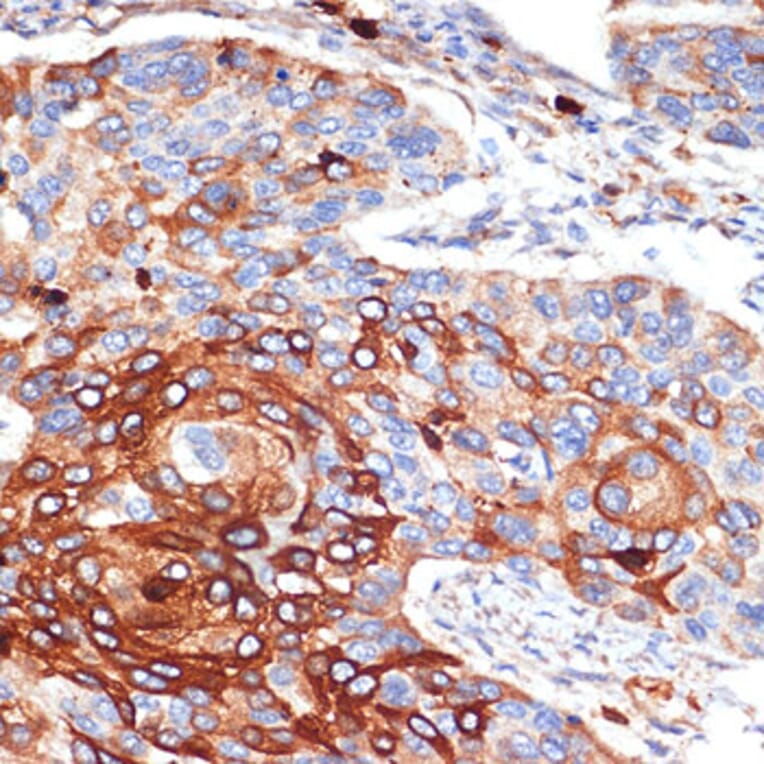 Immunohistochemistry - Anti-Alpha 1 Acid Glycoprotein/AGP Antibody [ARC2263] (A306936) - Antibodies.com