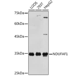 Western Blot - Anti-NDUFAF1 Antibody [ARC2091] (A306937) - Antibodies.com