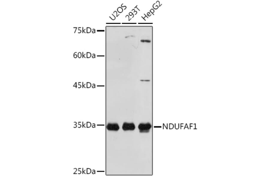 Western Blot - Anti-NDUFAF1 Antibody [ARC2091] (A306937) - Antibodies.com