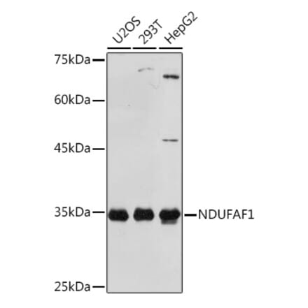 Western Blot - Anti-NDUFAF1 Antibody [ARC2091] (A306937) - Antibodies.com