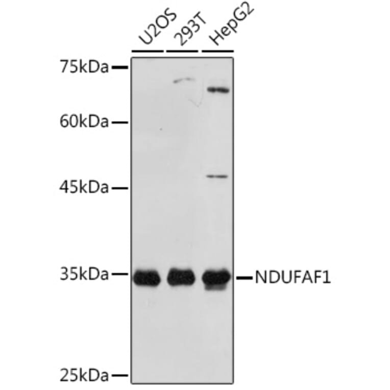 Western Blot - Anti-NDUFAF1 Antibody [ARC2091] (A306937) - Antibodies.com