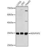 Western Blot - Anti-NDUFAF1 Antibody [ARC2091] (A306937) - Antibodies.com