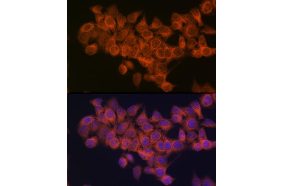 Immunofluorescence - Anti-NDUFAF1 Antibody [ARC2091] (A306937) - Antibodies.com