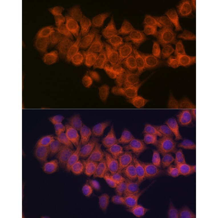 Immunofluorescence - Anti-NDUFAF1 Antibody [ARC2091] (A306937) - Antibodies.com