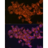 Immunofluorescence - Anti-NDUFAF1 Antibody [ARC2091] (A306937) - Antibodies.com