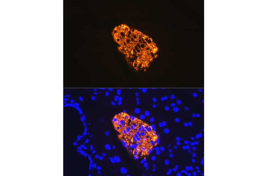 Immunofluorescence - Anti-Insulin Antibody [ARC0209] (A306938) - Antibodies.com