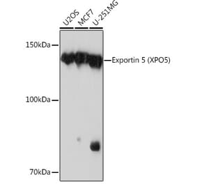 Western Blot - Anti-Exportin-5 Antibody [ARC0838] (A306939) - Antibodies.com