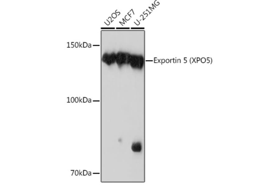 Western Blot - Anti-Exportin-5 Antibody [ARC0838] (A306939) - Antibodies.com