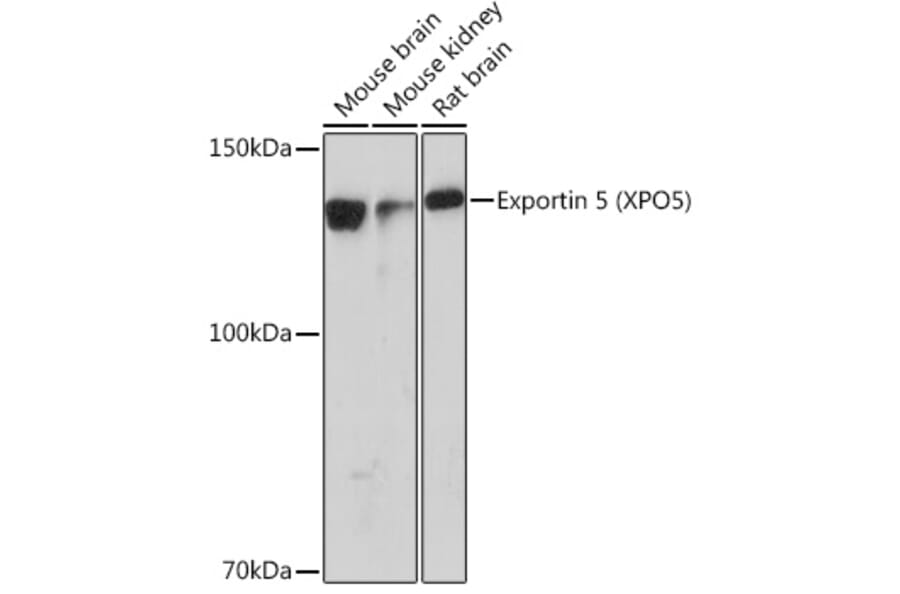 Western Blot - Anti-Exportin-5 Antibody [ARC0838] (A306939) - Antibodies.com