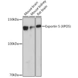 Western Blot - Anti-Exportin-5 Antibody [ARC0838] (A306939) - Antibodies.com