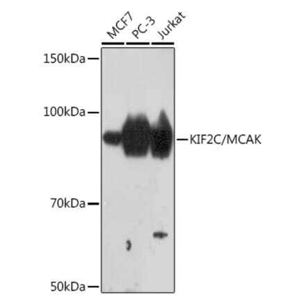 Western Blot - Anti-MCAK Antibody [ARC1447] (A306940) - Antibodies.com