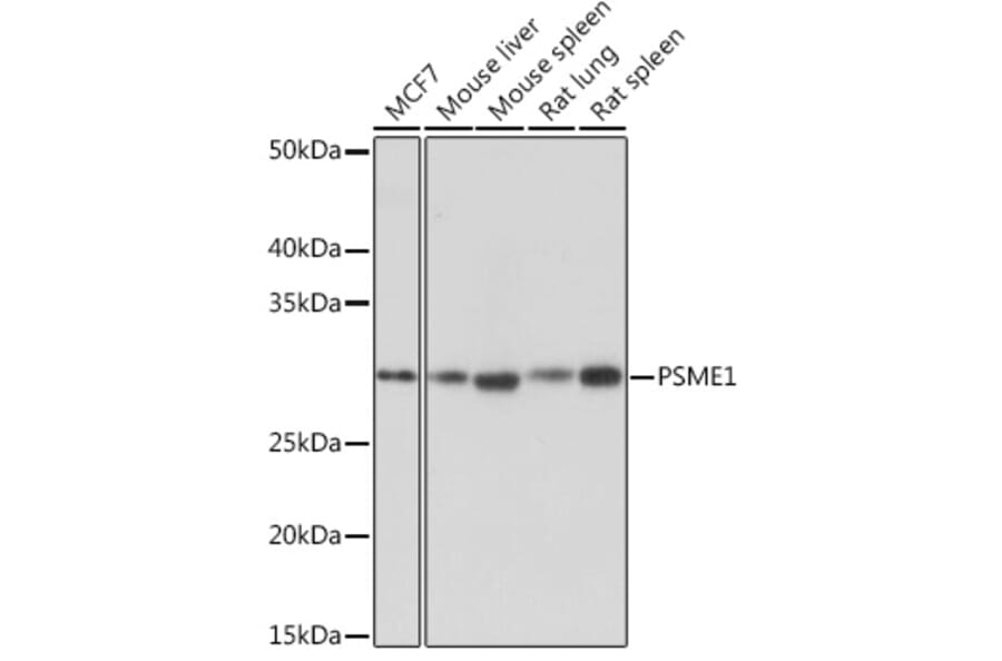 Western Blot - Anti-PSME1 Antibody [ARC1254] (A306941) - Antibodies.com