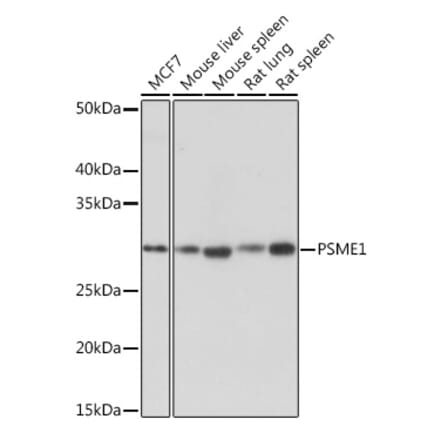 Western Blot - Anti-PSME1 Antibody [ARC1254] (A306941) - Antibodies.com