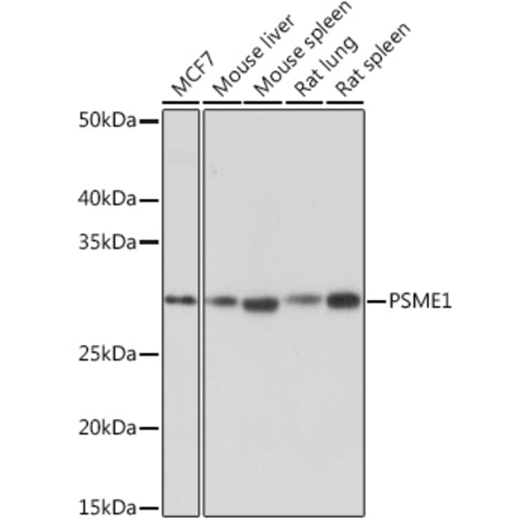 Western Blot - Anti-PSME1 Antibody [ARC1254] (A306941) - Antibodies.com