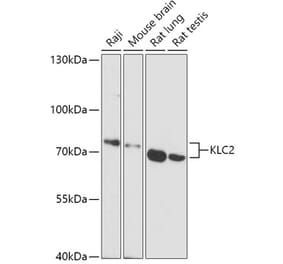 Western Blot - Anti-KLC2 Antibody (A306942) - Antibodies.com