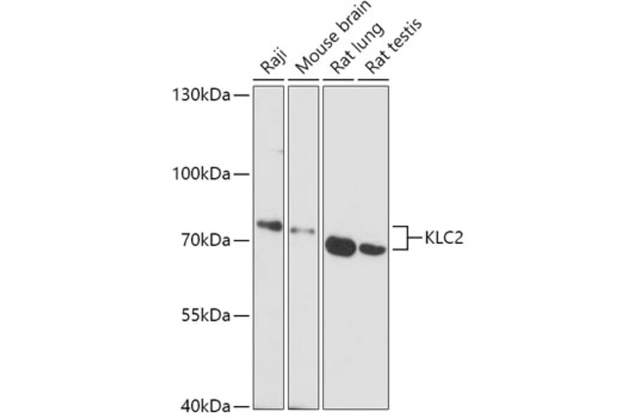 Western Blot - Anti-KLC2 Antibody (A306942) - Antibodies.com