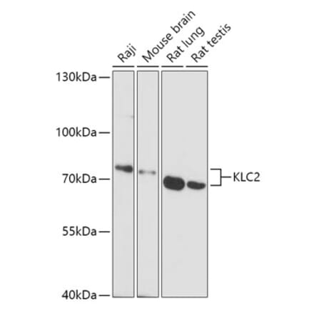 Western Blot - Anti-KLC2 Antibody (A306942) - Antibodies.com