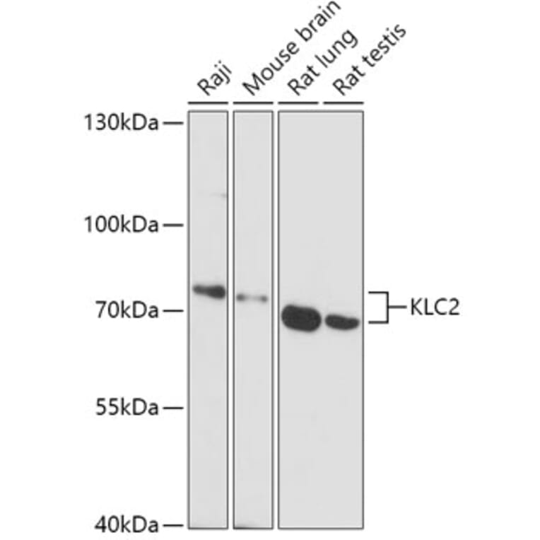 Western Blot - Anti-KLC2 Antibody (A306942) - Antibodies.com