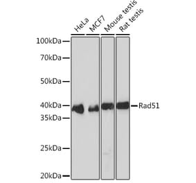 Western Blot - Anti-Rad51 Antibody [ARC0764] (A306943) - Antibodies.com