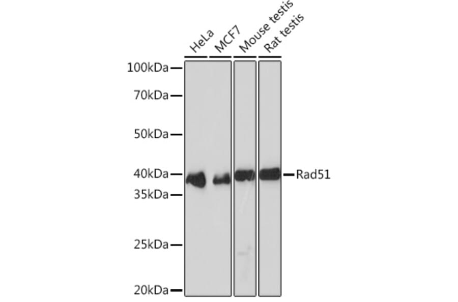 Western Blot - Anti-Rad51 Antibody [ARC0764] (A306943) - Antibodies.com