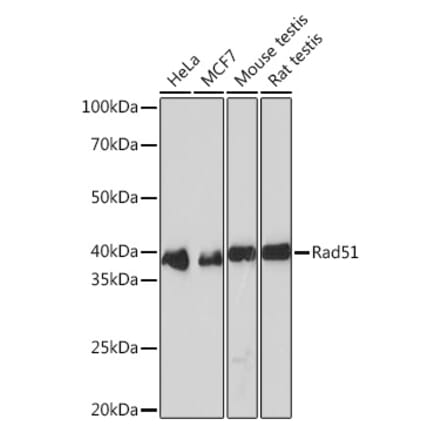 Western Blot - Anti-Rad51 Antibody [ARC0764] (A306943) - Antibodies.com